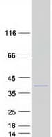Human TNNT3 Protein (Recombinant Myc-DDK (Flag))