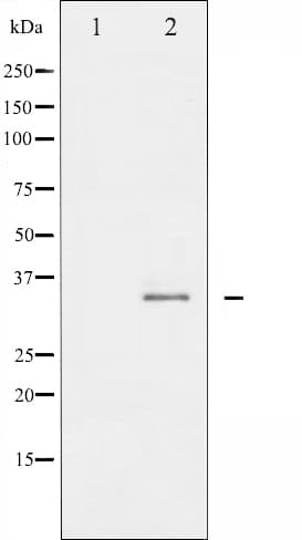 STX1A / Syntaxin 1A Antibody (phospho-Ser14)