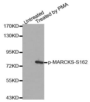 MARCKS Antibody (phospho-Ser162)