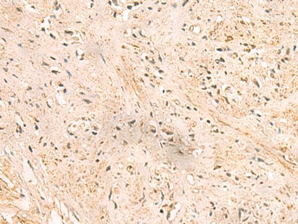 Polyclonal Rabbit anti-Human SSSCA1 / p27 Antibody (IHC)