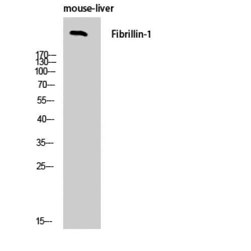Polyclonal Rabbit anti-Human FBN1 / Fibrillin 1 Antibody (2780-2860 aa, C-terminal, IHC, WB)