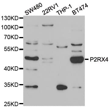 Polyclonal Rabbit anti-Human P2RX4 / P2X4 Antibody (IHC, IF, WB)