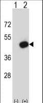 Polyclonal Rabbit anti-Mouse PDK2 Antibody (aa78-107, IHC, WB)