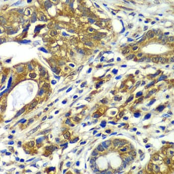 APC6 / CDC16 Antibody