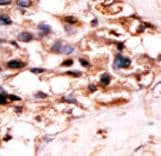 Polyclonal Rabbit anti-Human UCKL1 Antibody (aa60-90, IHC, WB)