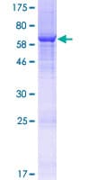 Human BRCTD1 / ANKRD32 Protein (Recombinant GST)
