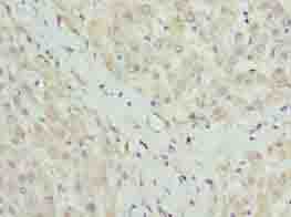 Polyclonal Rabbit anti-Human CLYBL Antibody (IHC, WB)