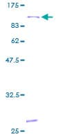 Human ALOX15 / 15-Lipoxygenase Protein (Recombinant GST)