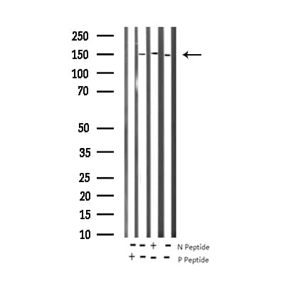 EGFR Antibody (phospho-Tyr1172)