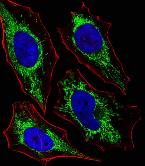 GLS / Glutaminase Antibody (aa516-545)