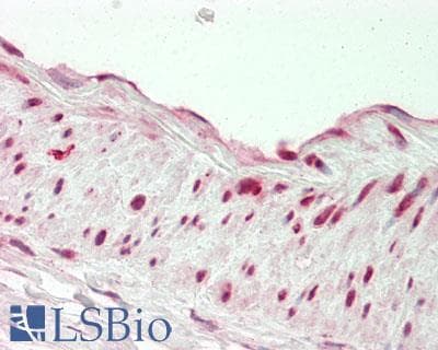 IHC-plus™ RNF2 / RING2 / RING1B Antibody (aa150-200)