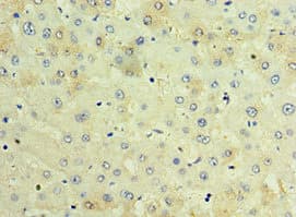 TCTN2 Antibody (aa420-670)