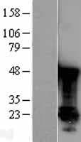 PARK7 / DJ-1 Protein (Over-Expression Lysate Myc-DDK (Flag))