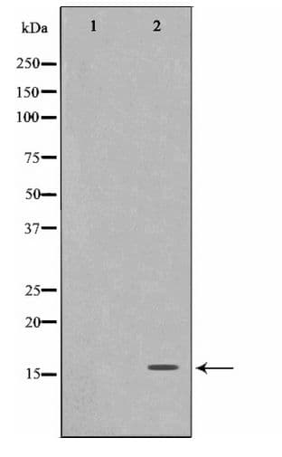 FHIT Antibody