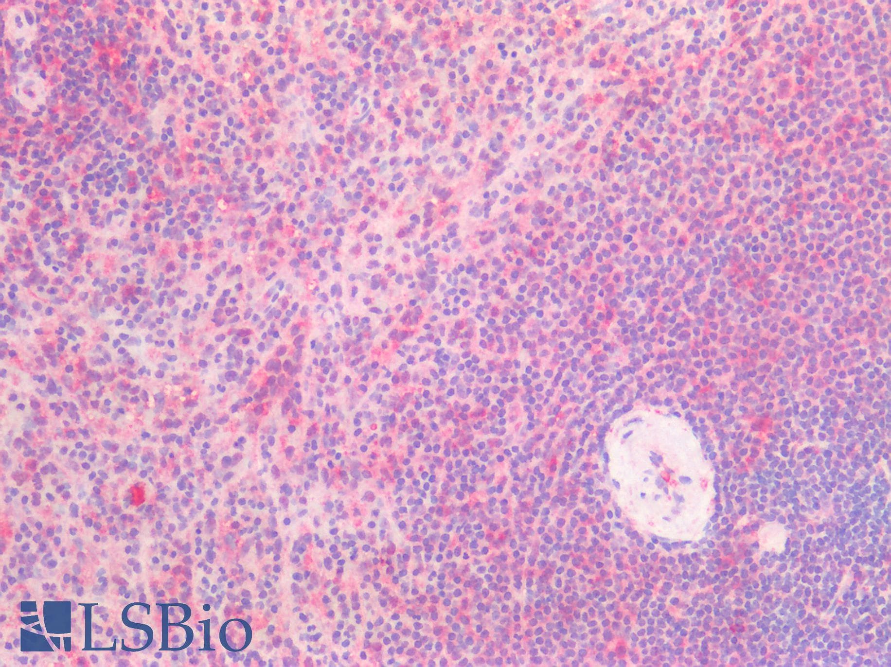 IHC-plus™ Polyclonal Rabbit anti-Human THBD / CD141 / Thrombomodulin Antibody (IHC, WB)