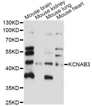 KCNAB3 Antibody
