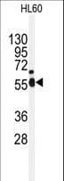 IHC-plus™ NEK2 Antibody (aa396-426)