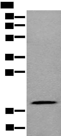 ZNHIT1 Antibody