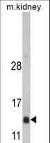 DNAJC19 Antibody (aa55-84)