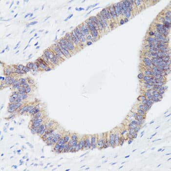 Polyclonal Rabbit anti-Human CTNNB1 / Beta Catenin Antibody (IHC, WB)
