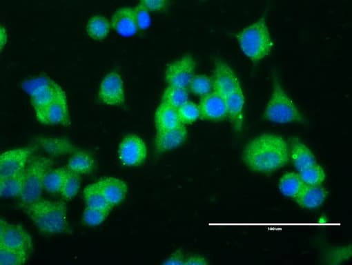 ERBB2 / HER2 Antibody (aa676-1255, clone UMAB34)
