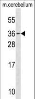 Polyclonal Rabbit anti-Mouse MESP1 Antibody (aa62-91, WB)