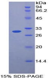 Mouse Neurotrypsin Protein (Recombinant His-T7)