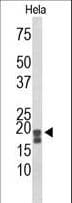 ACP1 / Acid Phosphatase Antibody (aa33-61)