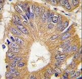 EIF4EBP1 / 4EBP1 Antibody (Thr69)