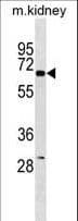 Monoclonal Mouse anti-Human KCNJ3 / GIRK1 Antibody (aa390-418, WB)