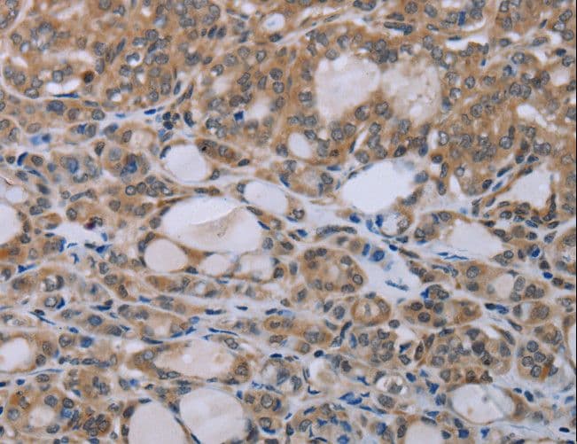 Polyclonal Rabbit anti-Human BIRC1 / NAIP Antibody (IHC)