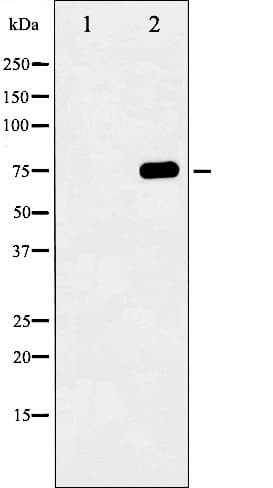 MAPT / Tau Antibody (phospho-Ser404)