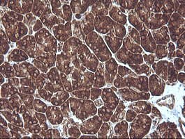 MAP2K1 / MKK1 / MEK1 Antibody (clone OTI4F1)
