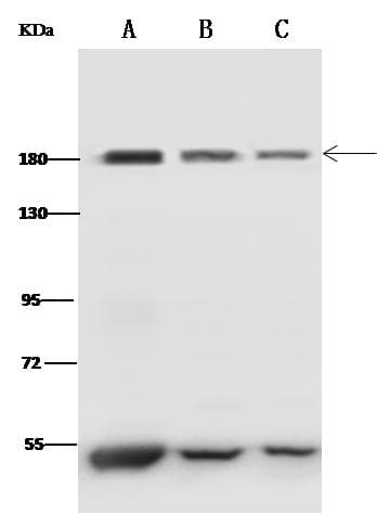 Polyclonal Rabbit anti-Mouse CLTC / Clathrin Heavy Chain Antibody (Preservative Free, IHC, WB)