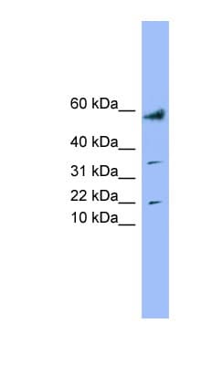 Polyclonal Rabbit anti-Human LYRM1 Antibody (aa35-84, WB)