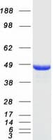 Human NDRG1 Protein (Recombinant Myc-DDK (Flag))