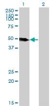 Monoclonal Mouse anti-Human LSP1 Antibody (clone 1C4, WB)