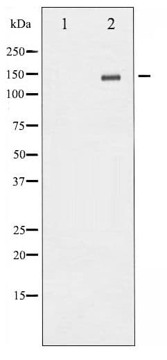 GRIN2B / NMDAR2B / NR2B Antibody (phospho-Tyr1336)