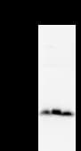 TWIST1 / TWIST Antibody (clone Twist2C1a)