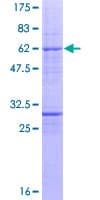 Human ESE3 / EHF Protein (Recombinant GST)