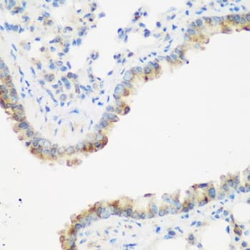 IMP-3 / IGF2BP3 Antibody