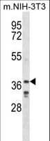 IHC-plus™ LHX6 Antibody (aa334-363)