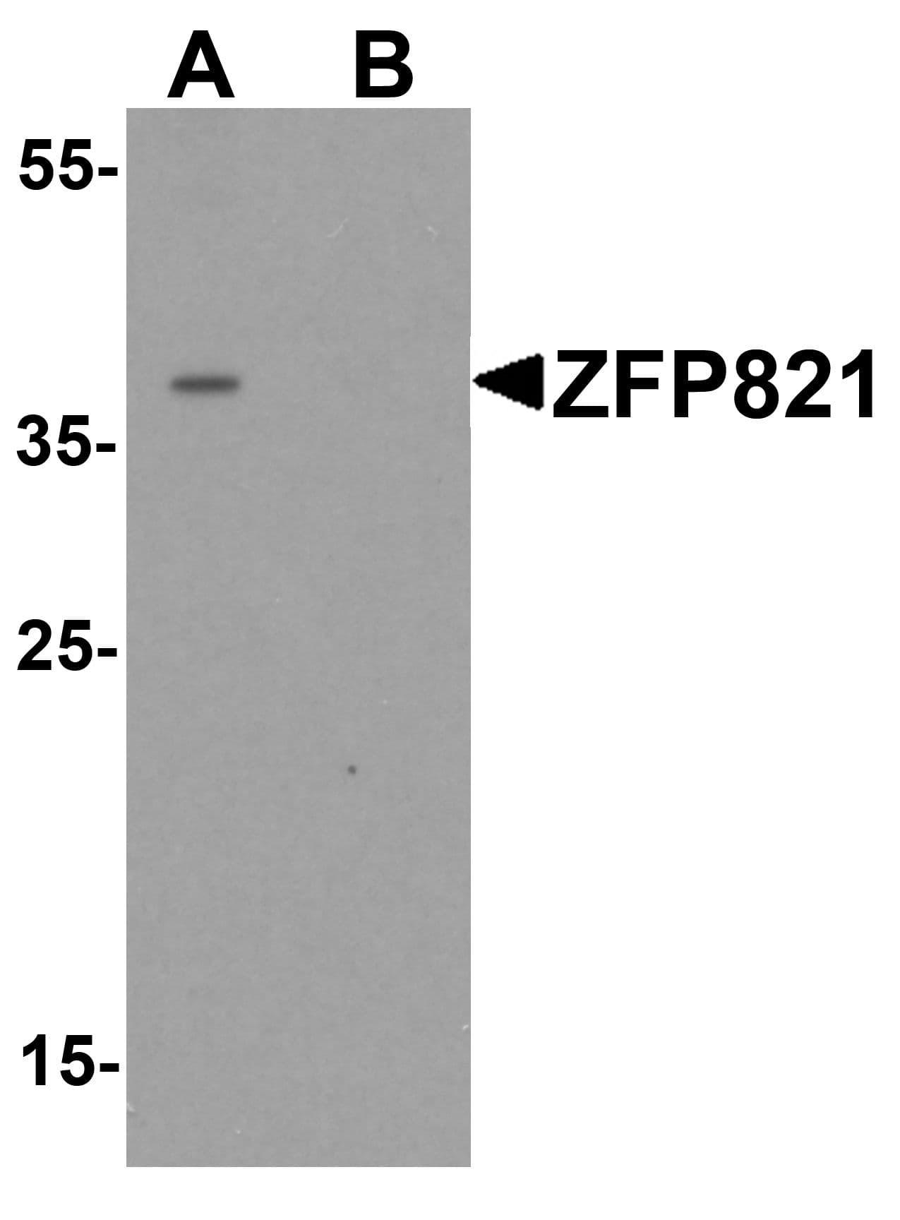IHC-plus™ ZNF821 Antibody