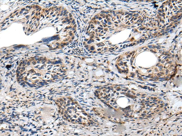 PRNP / PrP / Prion Antibody