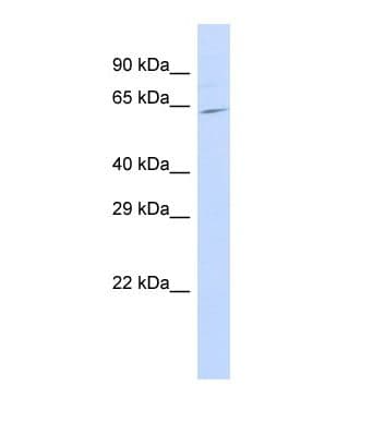 SLC25A13 / CITRIN Antibody (C-Terminus)