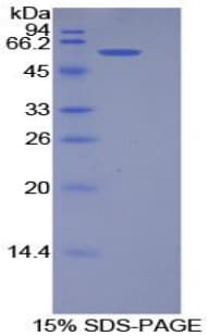 Human PODXL / Podocalyxin Protein (Recombinant His-GST)