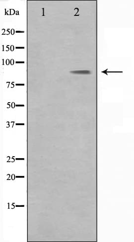 DMC1 Antibody