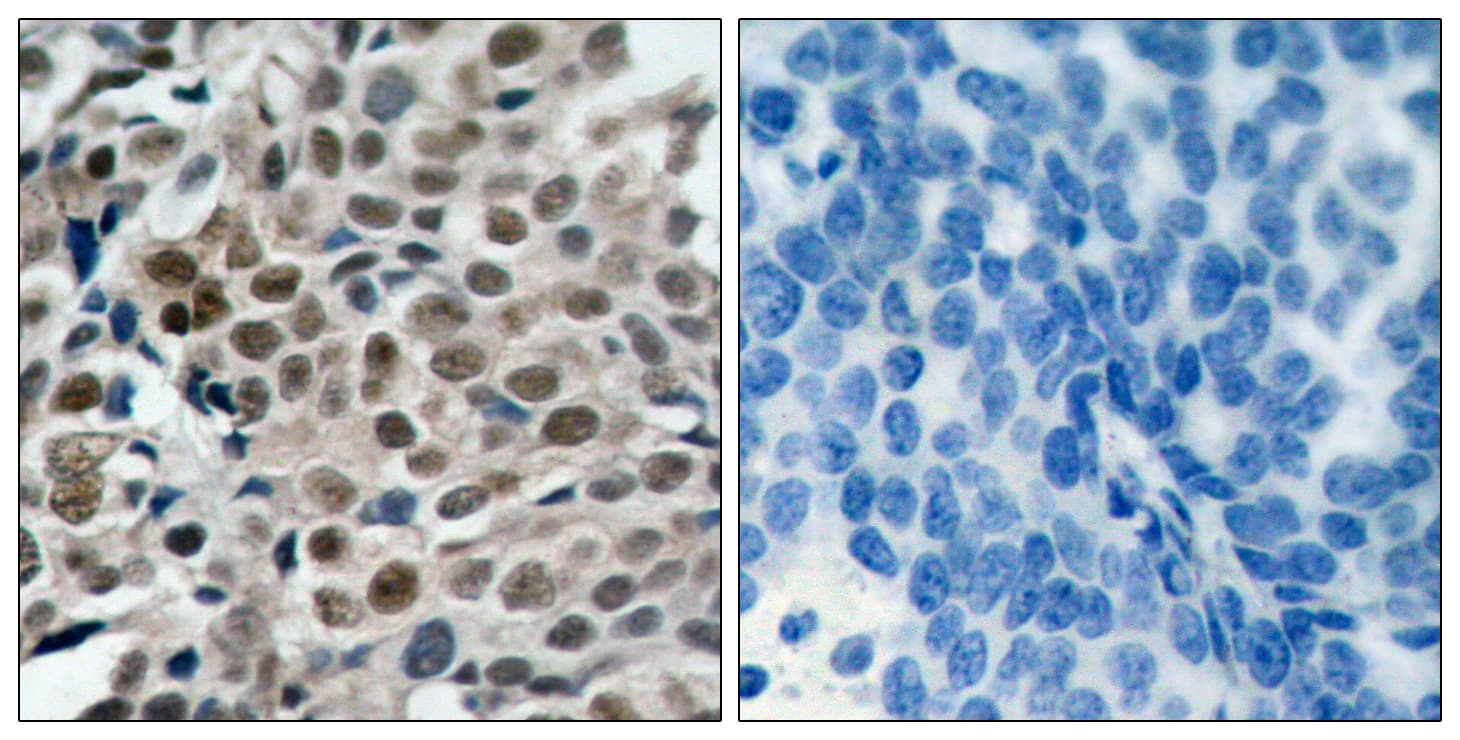 FOXO3 / FOXO3A Antibody (phospho-Ser253)