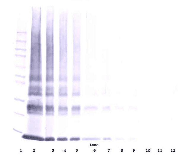 Polyclonal Rabbit anti-Human LGALS1 / Galectin 1 Antibody (Biotin, WB)
