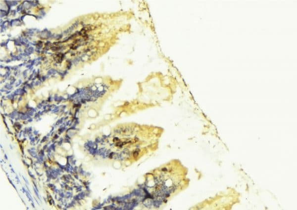 PGF / PLGF Antibody